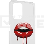 Чехол (клип-кейс) BORASCO ArtWorks, для Xiaomi Redmi Note 10/10S, прозрачный/рисунок, фото7